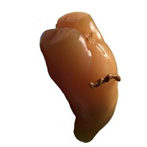 影像学培训新生儿躯干